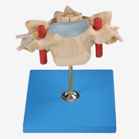 頸椎附脊髓和脊神經放大模型