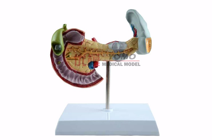 病變胰脾膽十二指腸模型